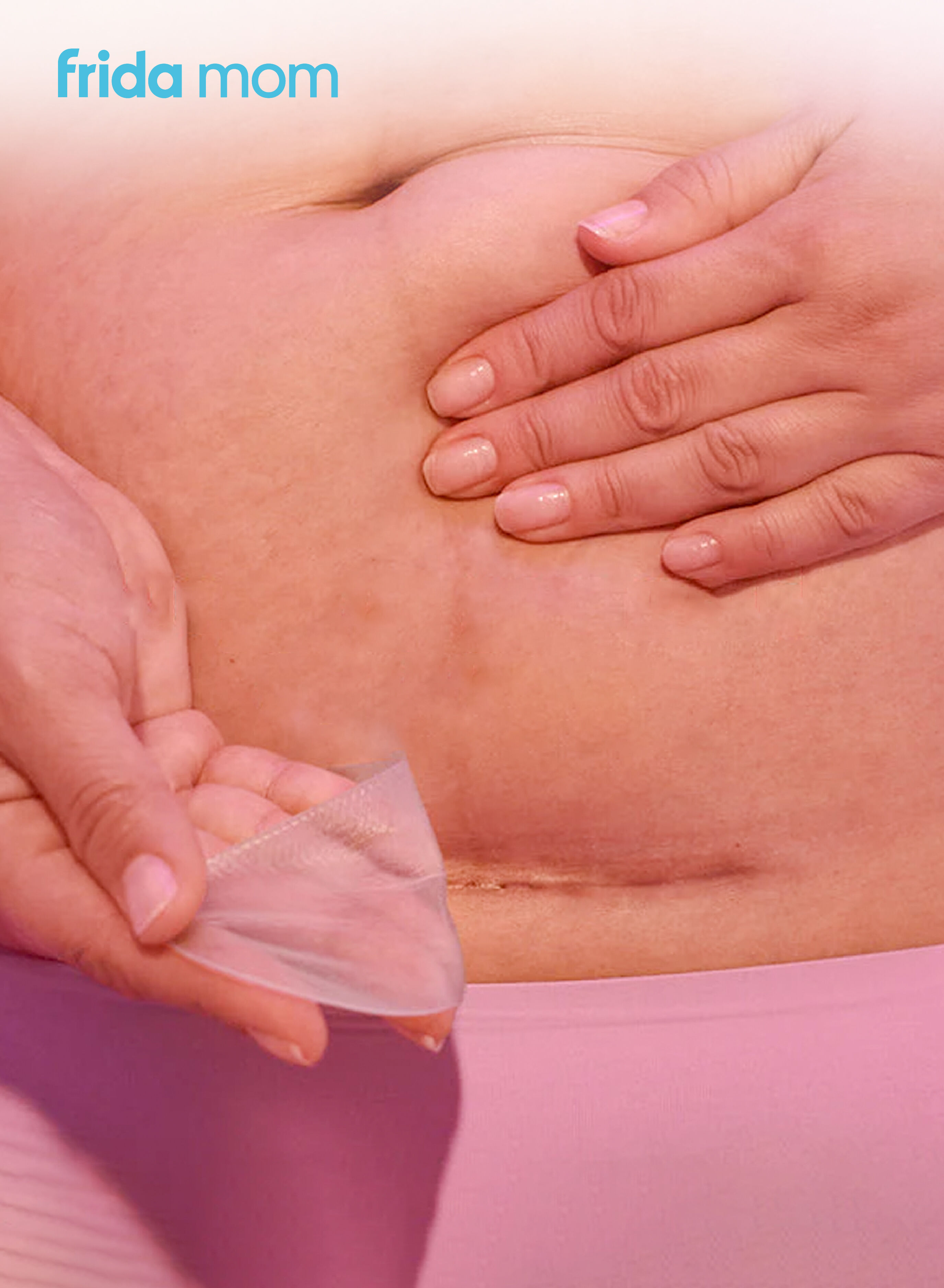 Frida Mom C-Section Silicone Scar Patches - 6 ct image number 2